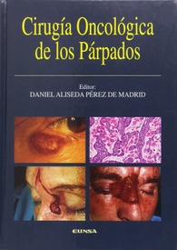 Cirugía oncológica de los párpados